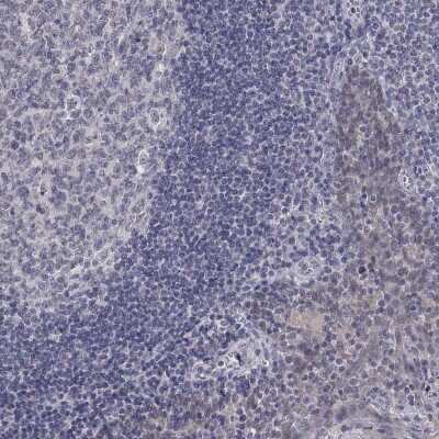 Immunohistochemistry-Paraffin: SLC22A2/OCT2 Antibody [NBP3-17065]