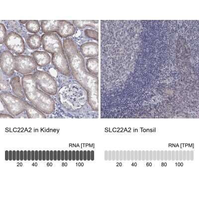 Immunohistochemistry-Paraffin: SLC22A2/OCT2 Antibody [NBP3-17065]