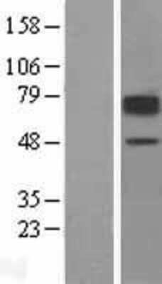 Western Blot: SLC22A2/OCT2 Overexpression Lysate [NBL1-16035]