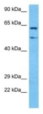 Western Blot: SLC22A20 Antibody [NBP3-10167]