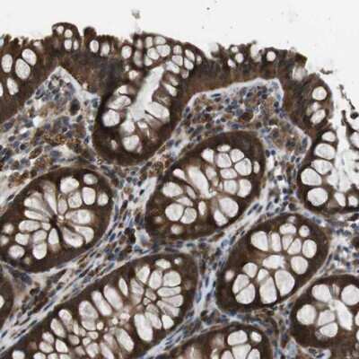 Immunohistochemistry-Paraffin: SLC22A23 Antibody [NBP1-91154]