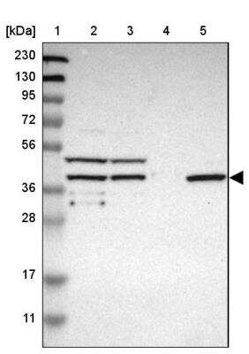 Western Blot: SLC22A23 Antibody [NBP1-91154]