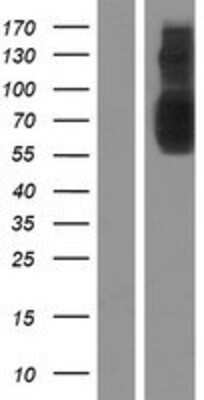 Western Blot: SLC22A23 Overexpression Lysate [NBP2-09871]