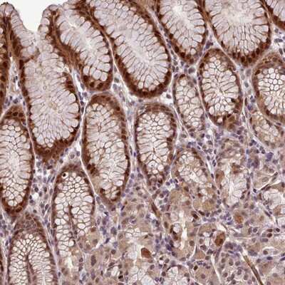 Immunohistochemistry-Paraffin: SLC22A24 Antibody [NBP2-14247]