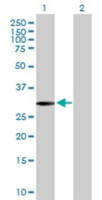 Western Blot: SLC22A24 Antibody [H00283238-B01P]