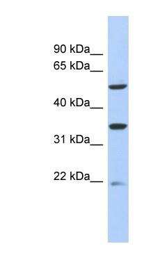 Western Blot: SLC22A24 Antibody [NBP1-56814]