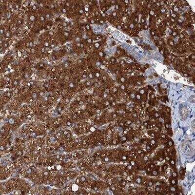 Immunohistochemistry-Paraffin: SLC22A25 Antibody [NBP1-81750]