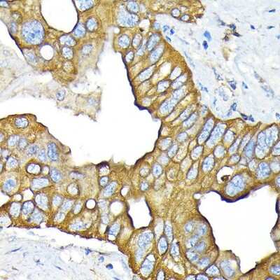 Immunohistochemistry-Paraffin: SLC22A3 Antibody (1K0A4) [NBP3-15897]