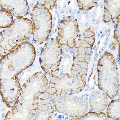 Immunohistochemistry-Paraffin: SLC22A3 Antibody (1K0A4) [NBP3-15897]