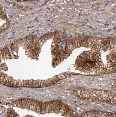 Immunohistochemistry-Paraffin: SLC22A3 Antibody [NBP1-83976]