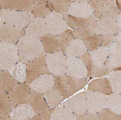 Immunohistochemistry-Paraffin: SLC22A3 Antibody [NBP1-83976]