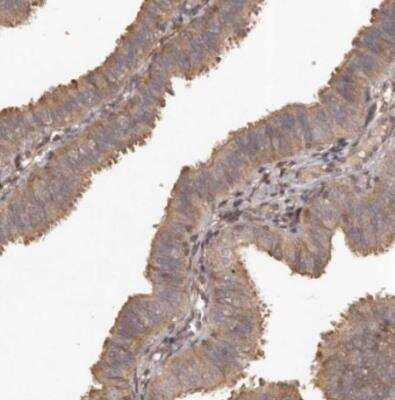 Immunohistochemistry-Paraffin: SLC22A3 Antibody [NBP1-83976]