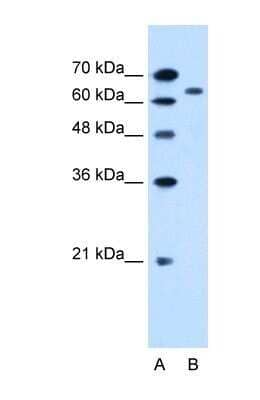 Western Blot: SLC22A3 Antibody [NBP1-69368]