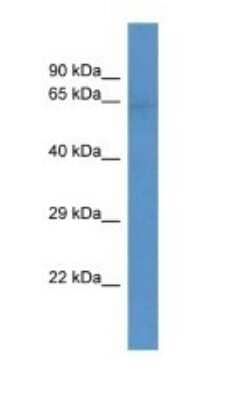 Western Blot: SLC22A3 Antibody [NBP1-80529]