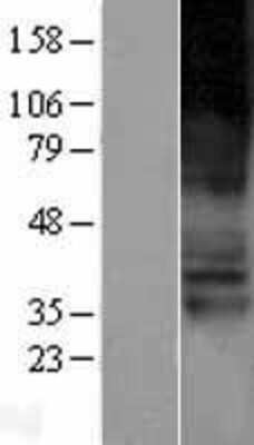 Western Blot: OCTN1/SLC22A4 Overexpression Lysate [NBP2-04242]