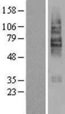 Western Blot: OCTN2/SLC22A5 Overexpression Lysate [NBL1-16037]