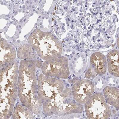 Immunohistochemistry-Paraffin: OAT1 Antibody [NBP2-62690]