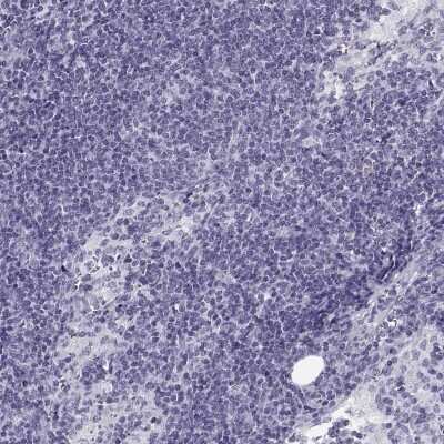 Immunohistochemistry-Paraffin: OAT1 Antibody [NBP2-62690]