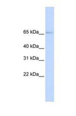 Western Blot: OAT1 Antibody [NBP1-69694]