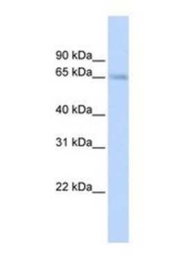 Western Blot: OAT1 Antibody [NBP1-69695]