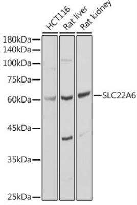 Western Blot: OAT1 AntibodyBSA Free [NBP2-94474]