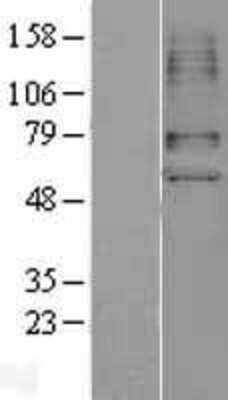 Western Blot: OAT1 Overexpression Lysate [NBL1-16038]