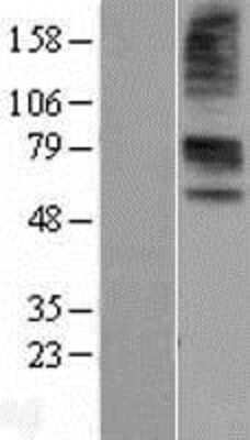 Western Blot: OAT1 Overexpression Lysate [NBL1-16039]