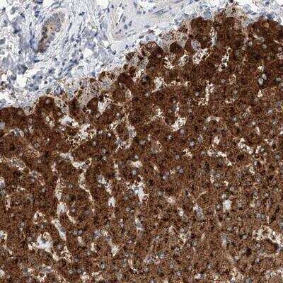 Immunohistochemistry-Paraffin: SLC22A7 Antibody [NBP1-82552]