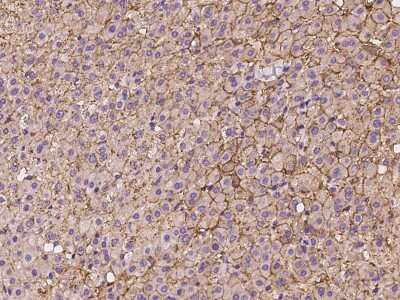Immunohistochemistry-Paraffin: SLC22A7 Antibody [NBP2-97992]