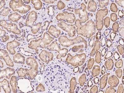 Immunohistochemistry-Paraffin: SLC22A7 Antibody [NBP2-97992]