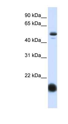 Western Blot: SLC22A7 Antibody [NBP1-62708]