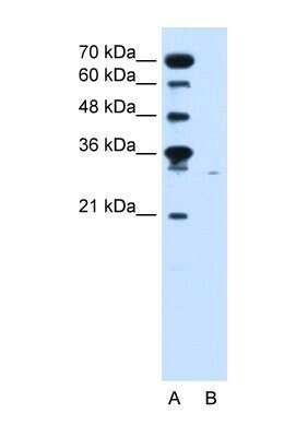 Western Blot: SLC22A7 Antibody [NBP1-69691]