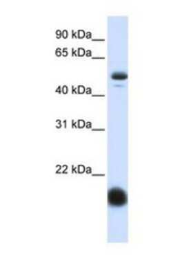 Western Blot: SLC22A7 Antibody [NBP1-69696]