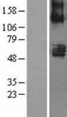 Western Blot: SLC22A7 Overexpression Lysate [NBL1-16040]