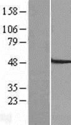 Western Blot: SLC22A7 Overexpression Lysate [NBP2-05266]