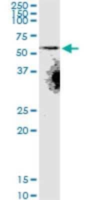 Western Blot: SLC22A8 Antibody (3C11) [H00009376-M02]