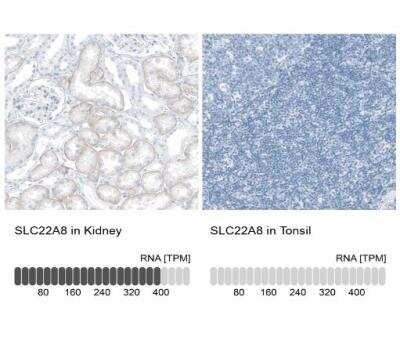 Immunohistochemistry-Paraffin: SLC22A8 Antibody [NBP1-92396]