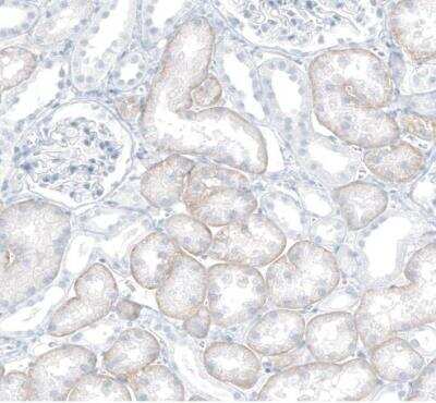 Immunohistochemistry-Paraffin: SLC22A8 Antibody [NBP1-92396]