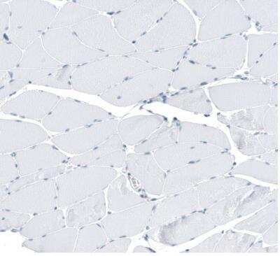 Immunohistochemistry-Paraffin: SLC22A8 Antibody [NBP1-92396]