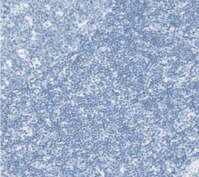 Immunohistochemistry-Paraffin: SLC22A8 Antibody [NBP1-92396]