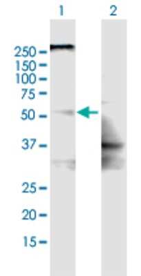 Western Blot: SLC22A8 Antibody [H00009376-B01P]