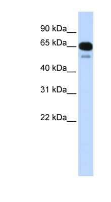 Western Blot: SLC22A8 Antibody [NBP1-60107]