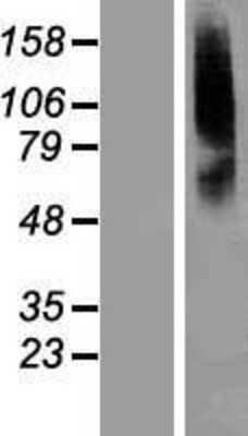 Western Blot: SLC22A8 Overexpression Lysate [NBL1-16042]