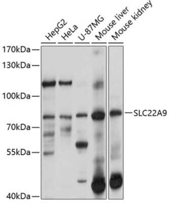 Western Blot: SLC22A9 AntibodyBSA Free [NBP2-94143]