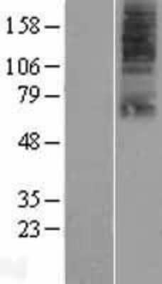 Western Blot: SLC22A9 Overexpression Lysate [NBP2-05754]