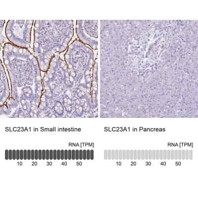 Immunohistochemistry-Paraffin: SLC23A1 Antibody [NBP2-13318]