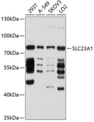 Western Blot: SLC23A1 AntibodyBSA Free [NBP2-93412]