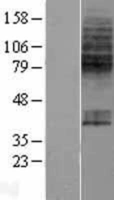 Western Blot: SLC23A1 Overexpression Lysate [NBP2-05322]