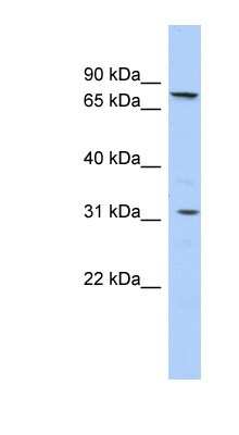 Western Blot: SLC23A2 Antibody [NBP1-59384]