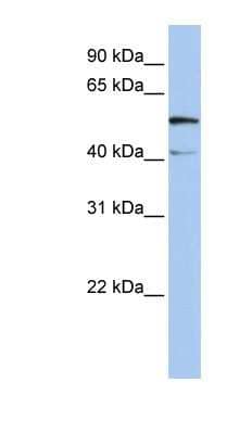 Western Blot: SLC23A3 Antibody [NBP1-59896]